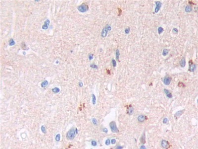 Monoclonal Antibody to Brain Natriuretic Peptide (BNP)