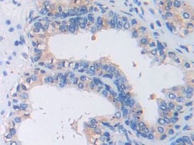 Monoclonal Antibody to Brain Natriuretic Peptide (BNP)