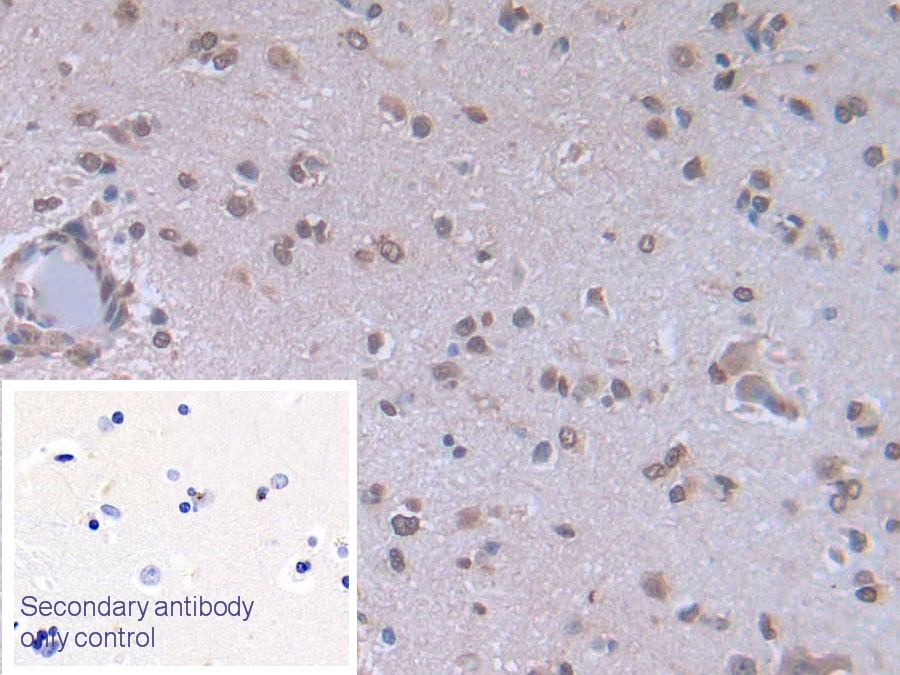 Monoclonal Antibody to Brain Natriuretic Peptide (BNP)