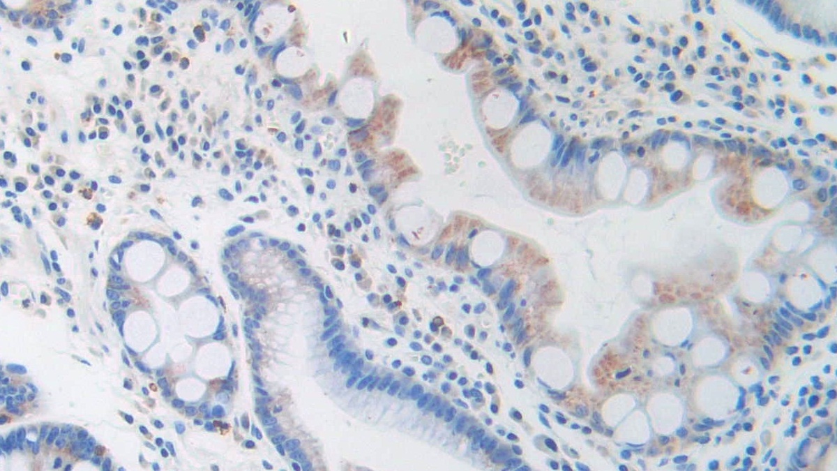 Monoclonal Antibody to Brain Natriuretic Peptide (BNP)