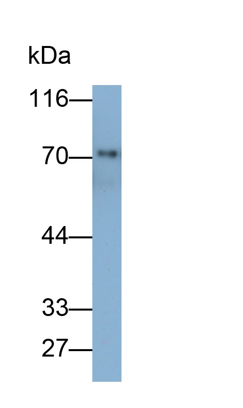 Monoclonal Antibody to Immunoglobulin M (IgM)