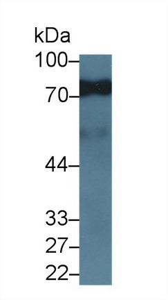 Monoclonal Antibody to Immunoglobulin M (IgM)