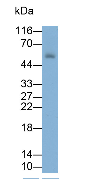 Monoclonal Antibody to Immunoglobulin G (IgG)