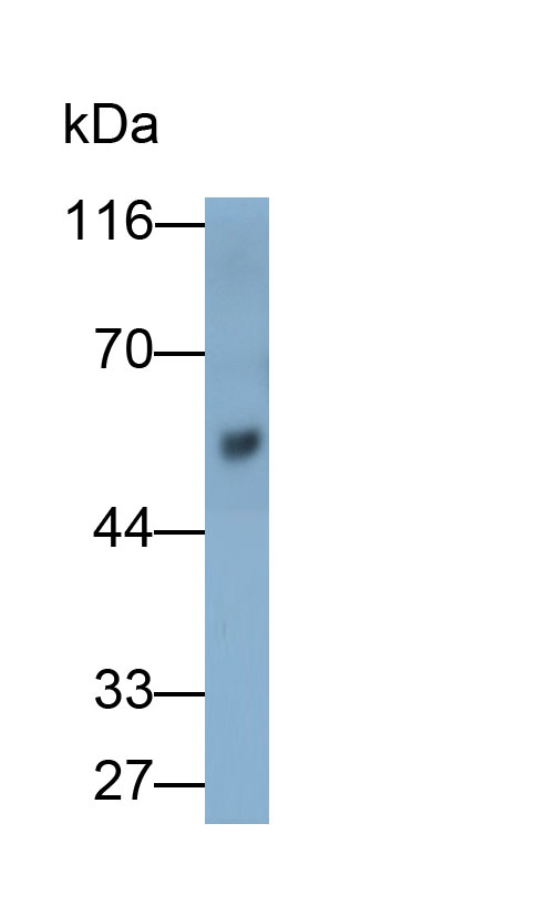 Monoclonal Antibody to Immunoglobulin G (IgG)