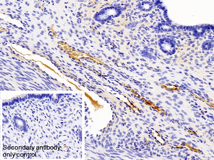 Monoclonal Antibody to Immunoglobulin G (IgG)