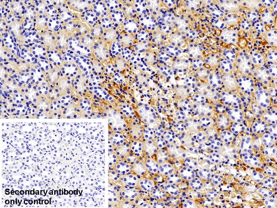 Monoclonal Antibody to Immunoglobulin G (IgG)