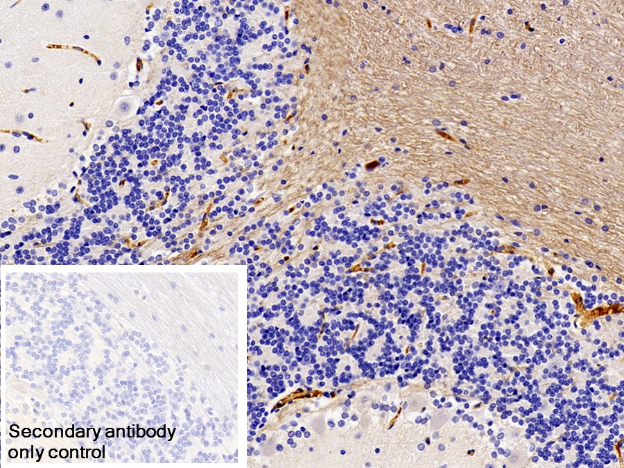 Monoclonal Antibody to Immunoglobulin G (IgG)