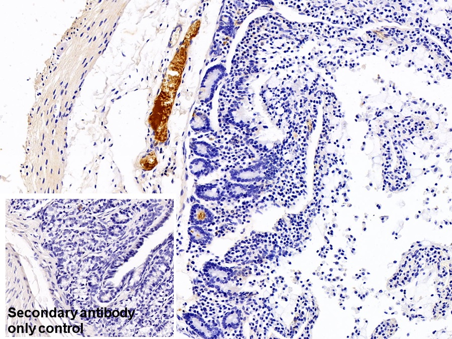 Monoclonal Antibody to Immunoglobulin G (IgG)