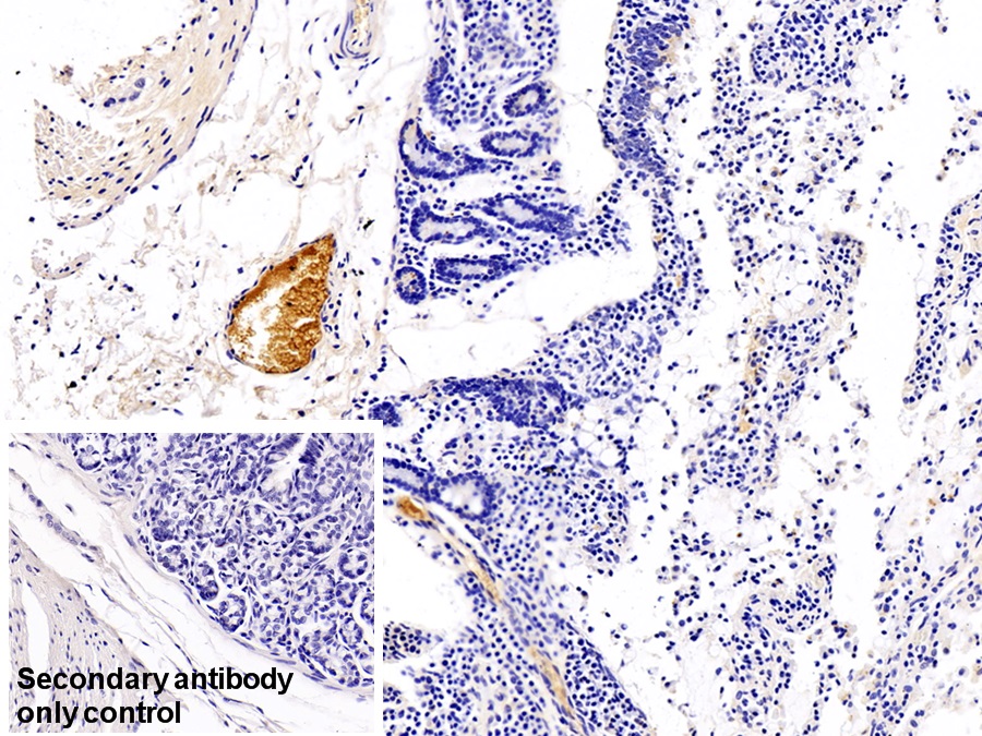 Monoclonal Antibody to Immunoglobulin G (IgG)