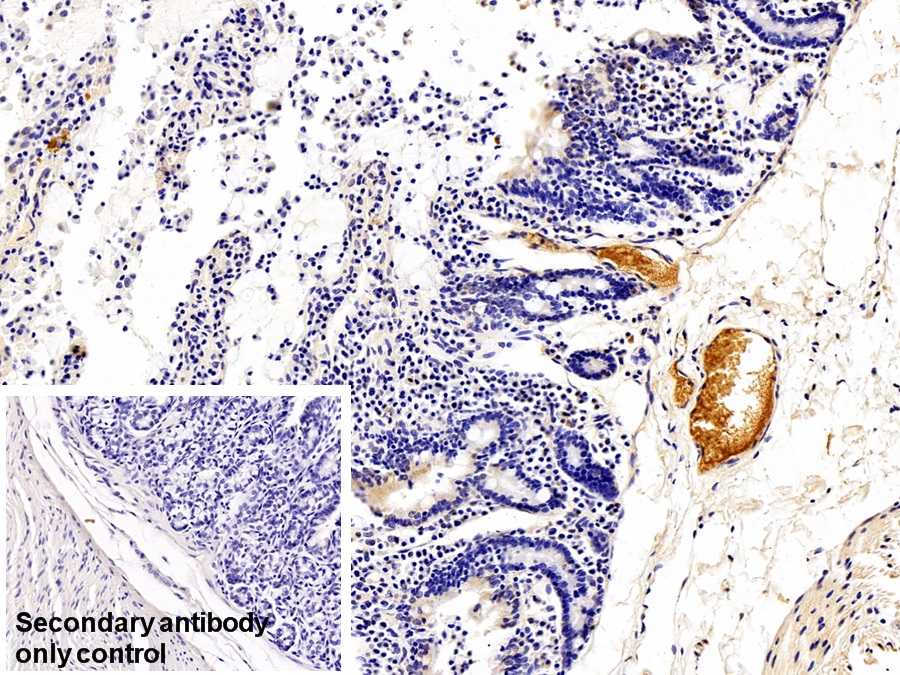 Monoclonal Antibody to Immunoglobulin G (IgG)