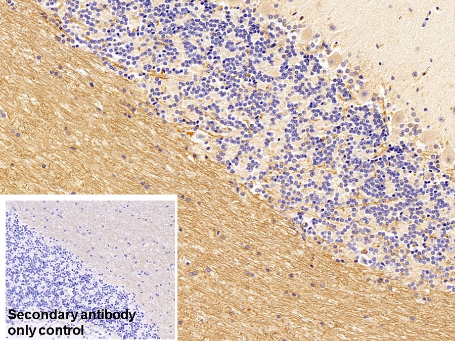 Monoclonal Antibody to Immunoglobulin G (IgG)