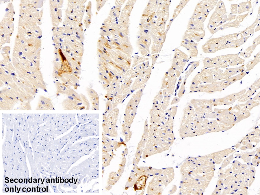 Monoclonal Antibody to Immunoglobulin G (IgG)