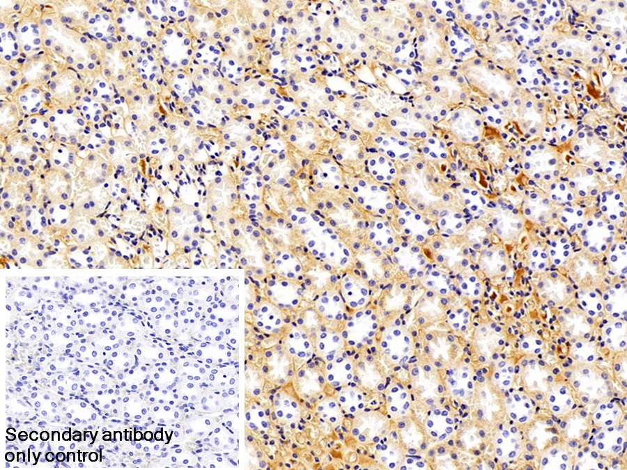 Monoclonal Antibody to Immunoglobulin G (IgG)