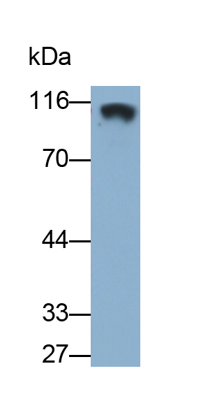 Monoclonal Antibody to Vascular Cell Adhesion Molecule 1 (VCAM1)