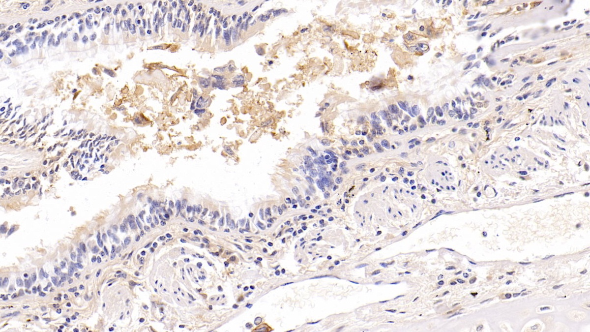 Monoclonal Antibody to Intercellular Adhesion Molecule 1 (ICAM1)