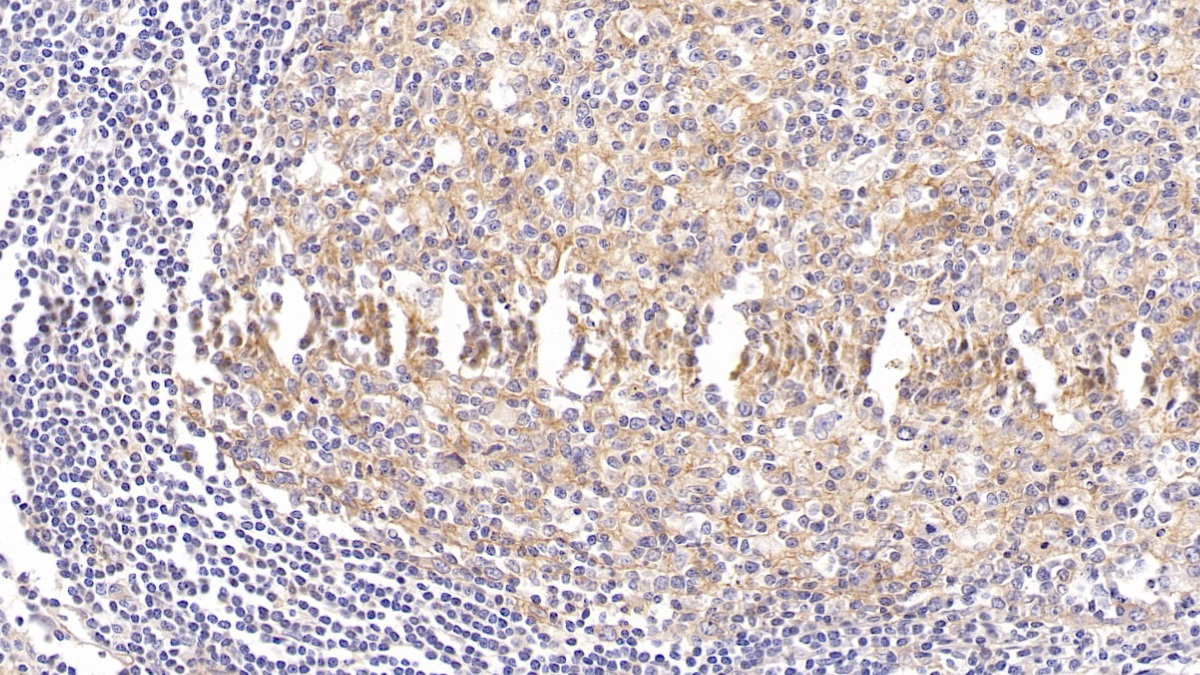 Monoclonal Antibody to Intercellular Adhesion Molecule 1 (ICAM1)