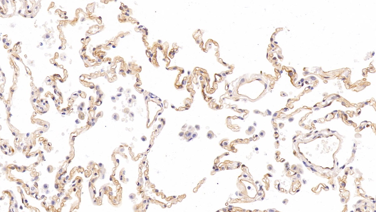 Monoclonal Antibody to Intercellular Adhesion Molecule 1 (ICAM1)