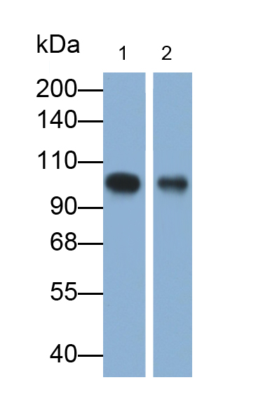 Monoclonal Antibody to Intercellular Adhesion Molecule 1 (ICAM1)
