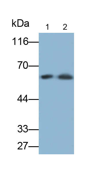 Monoclonal Antibody to Cytokeratin 9 (CK9)
