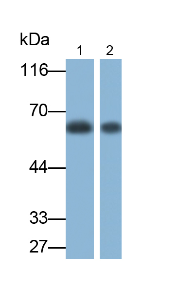 Monoclonal Antibody to Cytokeratin 9 (CK9)