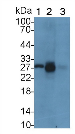 Monoclonal Antibody to Tissue Inhibitors Of Metalloproteinase 1 (TIMP1)