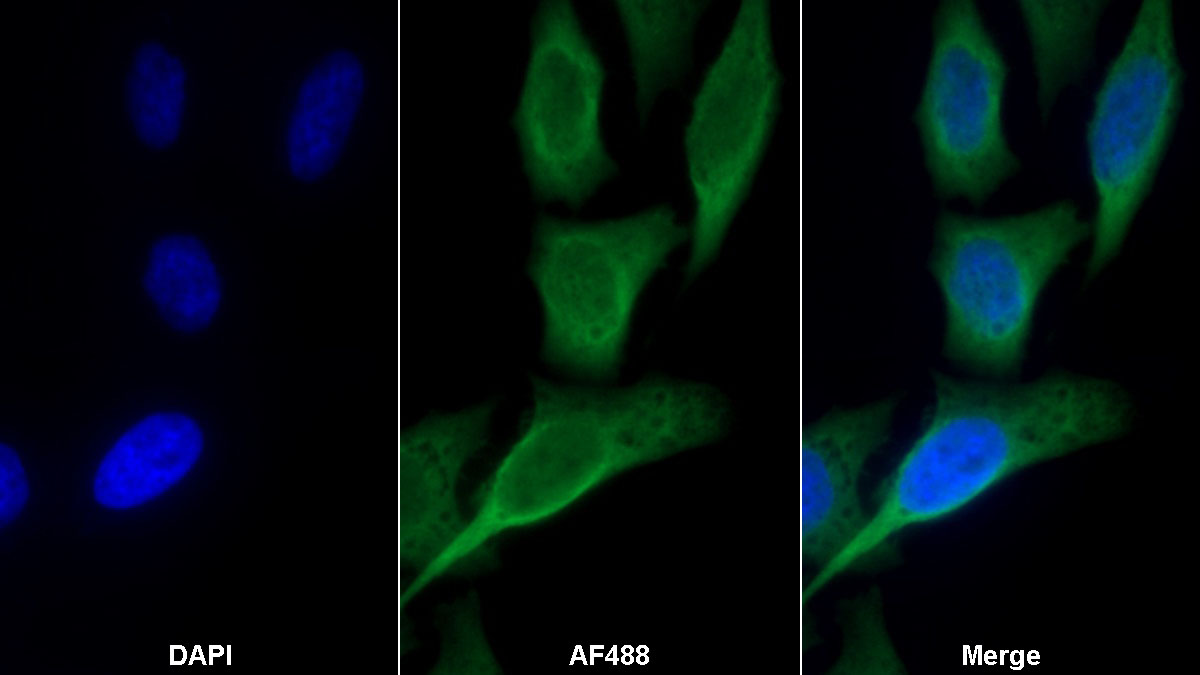 Monoclonal Antibody to Tissue Inhibitors Of Metalloproteinase 1 (TIMP1)