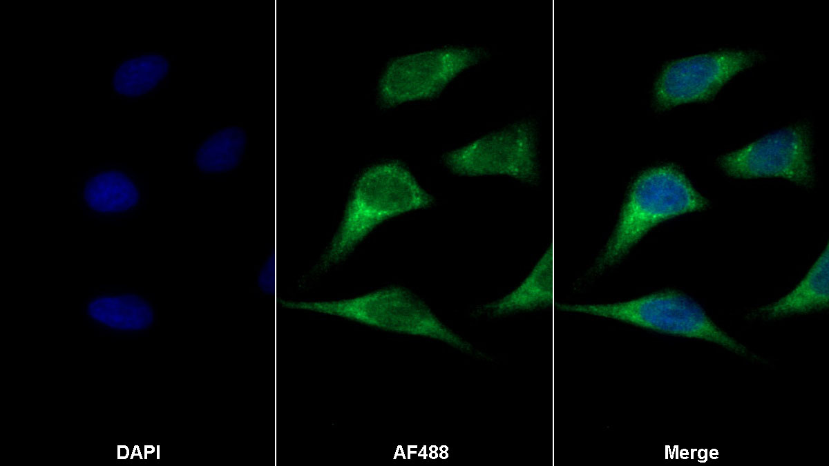 Monoclonal Antibody to Matrix Metalloproteinase 9 (MMP9)