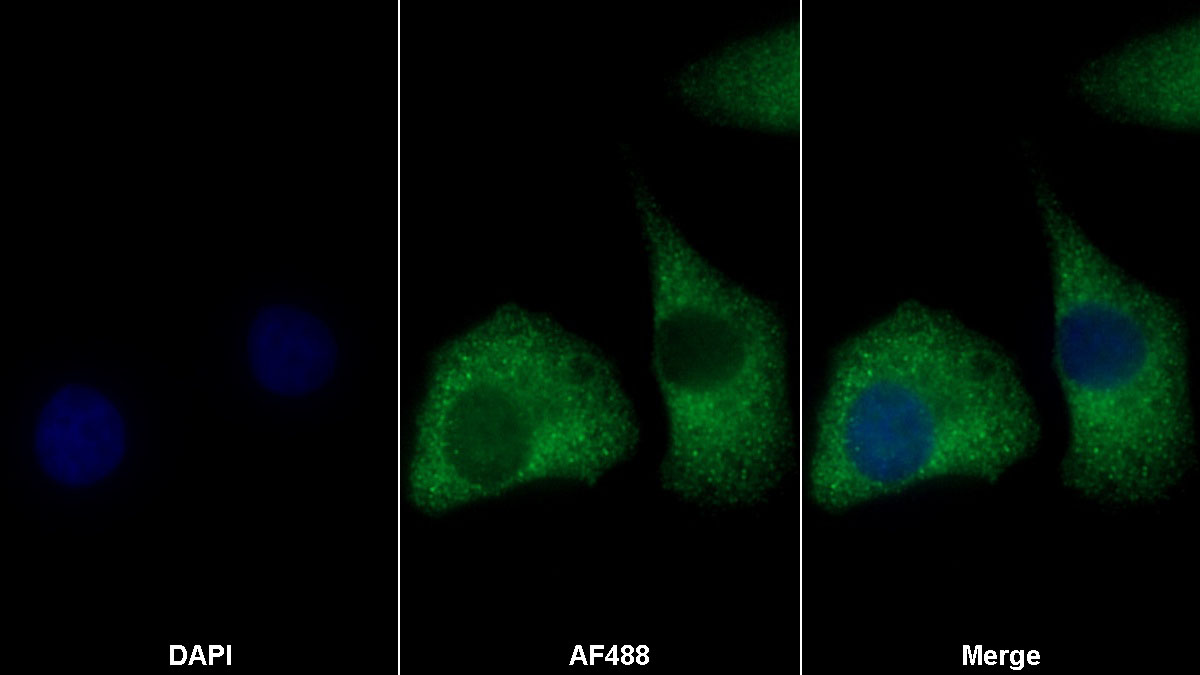 Monoclonal Antibody to Matrix Metalloproteinase 9 (MMP9)