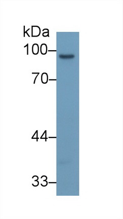 Monoclonal Antibody to Matrix Metalloproteinase 9 (MMP9)