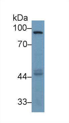 Monoclonal Antibody to Matrix Metalloproteinase 9 (MMP9)