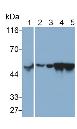 Monoclonal Antibody to Cytokeratin 7 (CK7)