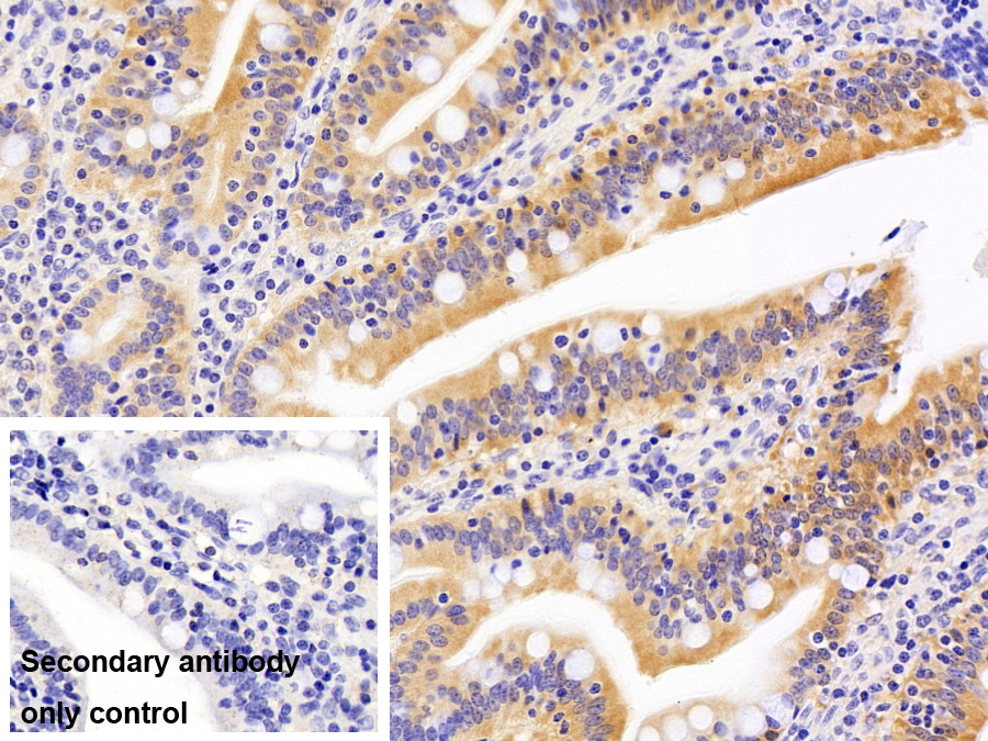 Monoclonal Antibody to Fatty Acid Binding Protein 2, Intestinal (FABP2)