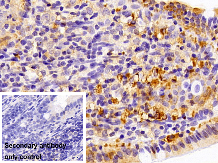 Monoclonal Antibody to Fatty Acid Binding Protein 2, Intestinal (FABP2)