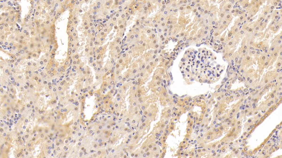 Monoclonal Antibody to Epidermal Growth Factor (EGF)