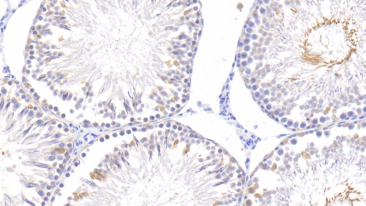 Monoclonal Antibody to Epidermal Growth Factor (EGF)