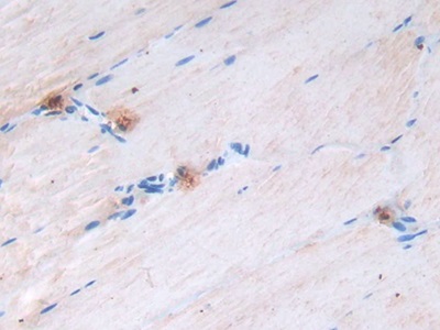 Monoclonal Antibody to Epidermal Growth Factor (EGF)
