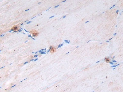 Monoclonal Antibody to Epidermal Growth Factor (EGF)