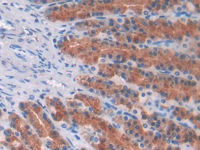 Monoclonal Antibody to Epidermal Growth Factor (EGF)