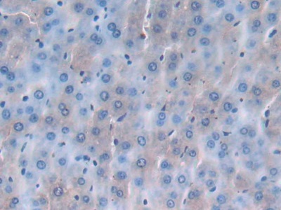 Monoclonal Antibody to Epidermal Growth Factor (EGF)
