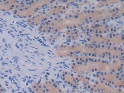 Monoclonal Antibody to Epidermal Growth Factor (EGF)