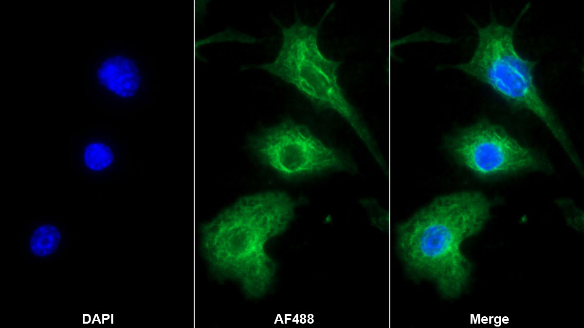 Monoclonal Antibody to Interleukin 1 Beta (IL1b)