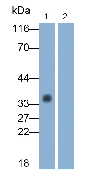 Monoclonal Antibody to Interleukin 1 Beta (IL1b)
