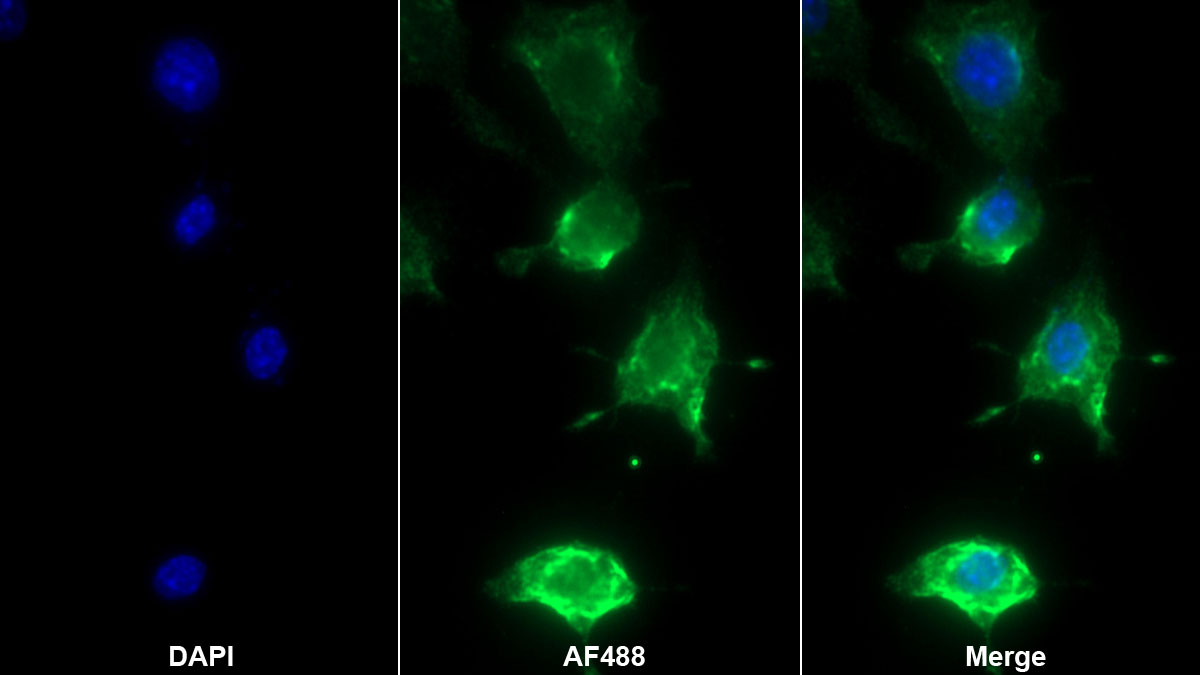 Monoclonal Antibody to Interleukin 1 Beta (IL1b)