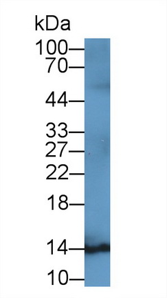 Monoclonal Antibody to S100 Calcium Binding Protein B (S100B)