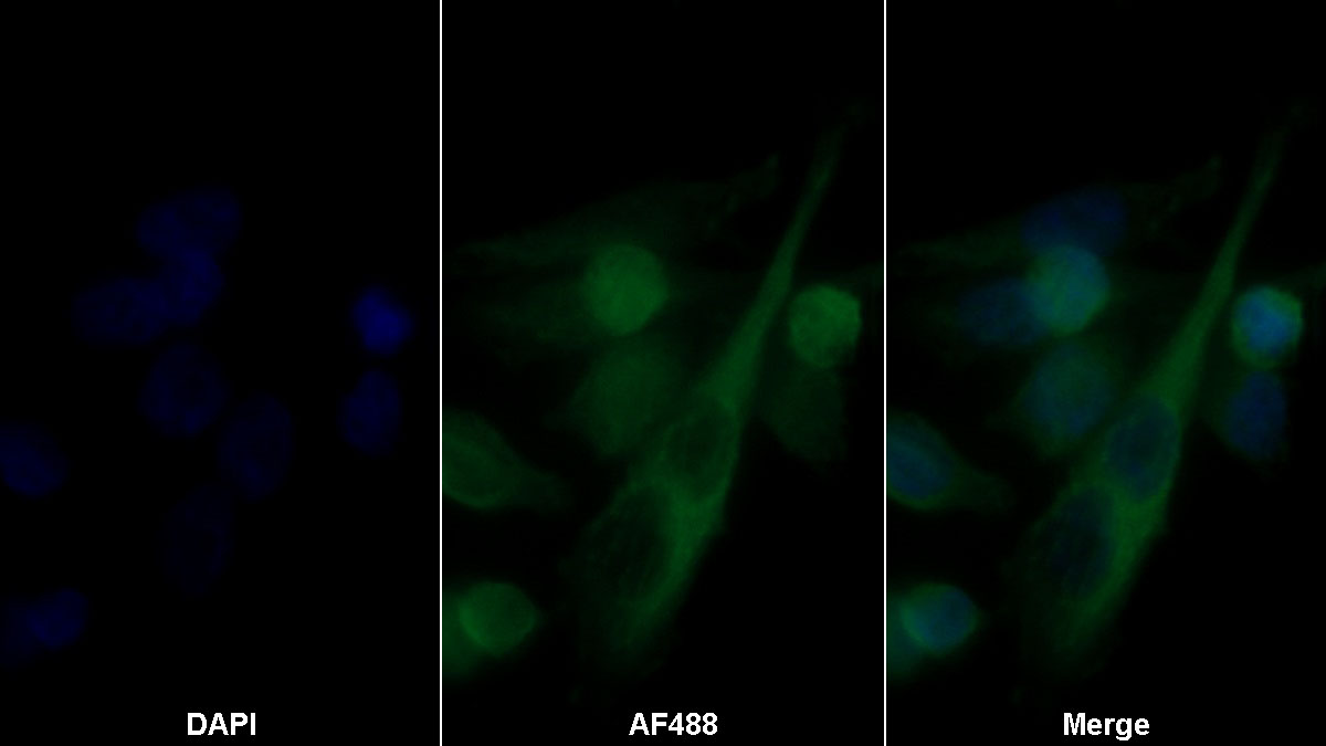 Monoclonal Antibody to S100 Calcium Binding Protein B (S100B)