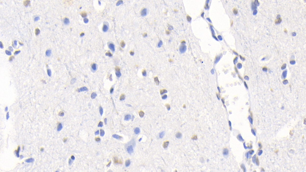 Monoclonal Antibody to S100 Calcium Binding Protein B (S100B)