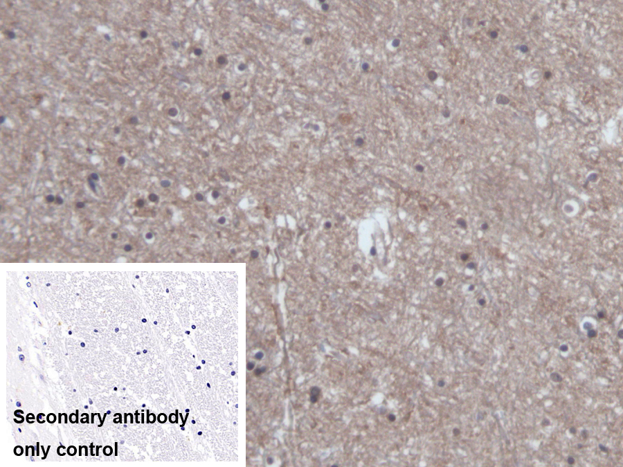 Monoclonal Antibody to S100 Calcium Binding Protein B (S100B)