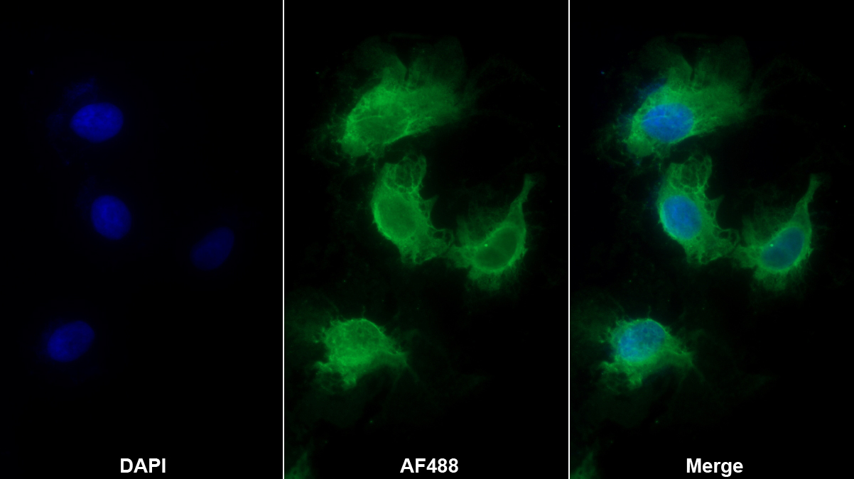 Monoclonal Antibody to S100 Calcium Binding Protein B (S100B)
