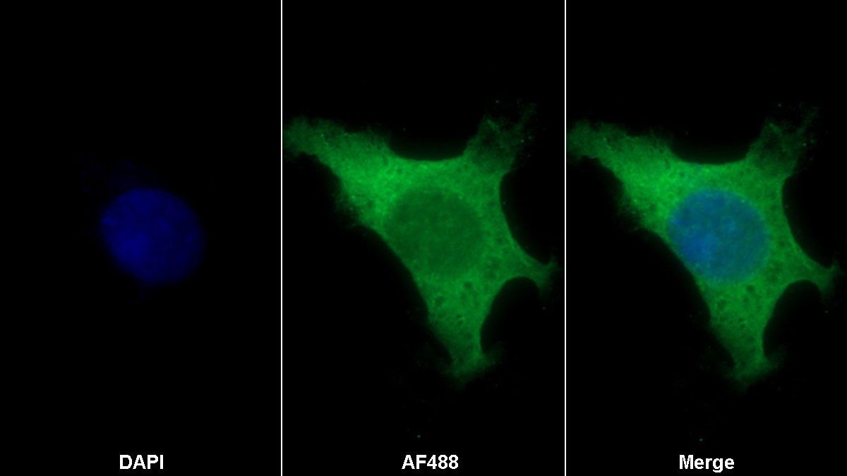 Monoclonal Antibody to S100 Calcium Binding Protein B (S100B)