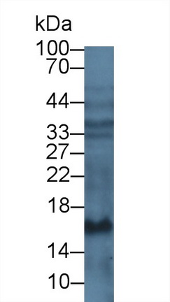 Monoclonal Antibody to Procollagen III N-Terminal Propeptide (PIIINP)